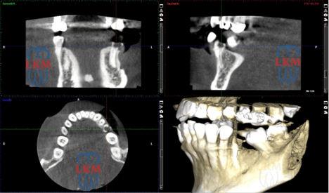 Dental X-ray