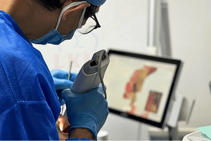 3D Intraoral Scanning