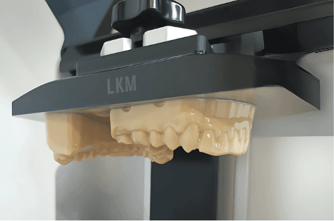 3D Printed Prosthesis