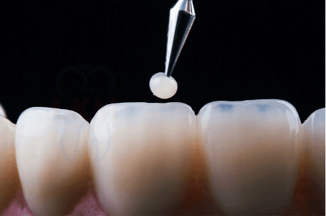 Restorative Dentistry