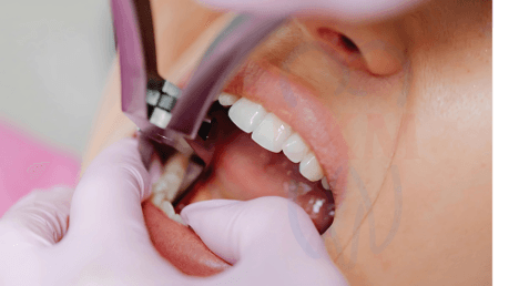 Oral Surgical Procedures